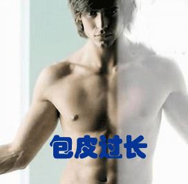 风靡欧美，新乡首推——美式光离子包皮微创术